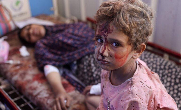 ataques-de-israel-deixam-ao-menos-30-mortos-em-escolas-em-gaza