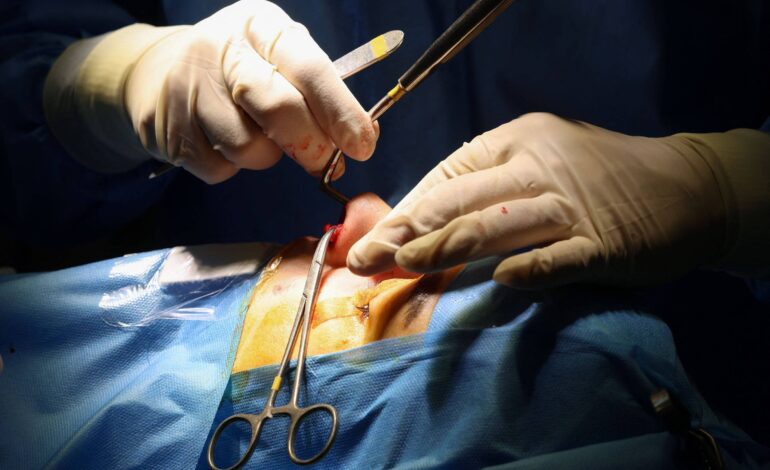 iranianas-realizam-cirurgias-esteticas-para-alcancar-melhores-oportunidades