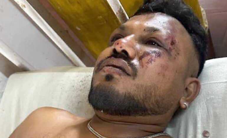 novo-video-mostra-unico-sobrevivente-caminhando-apos-queda-de-aviao-na-india