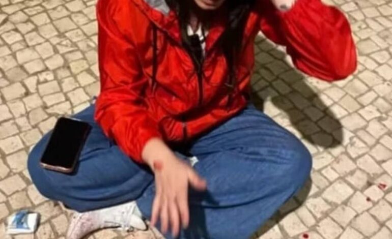 brasileira-diz-que-levou-pedrada-na-cabeca-e-foi-xingada-em-portugal