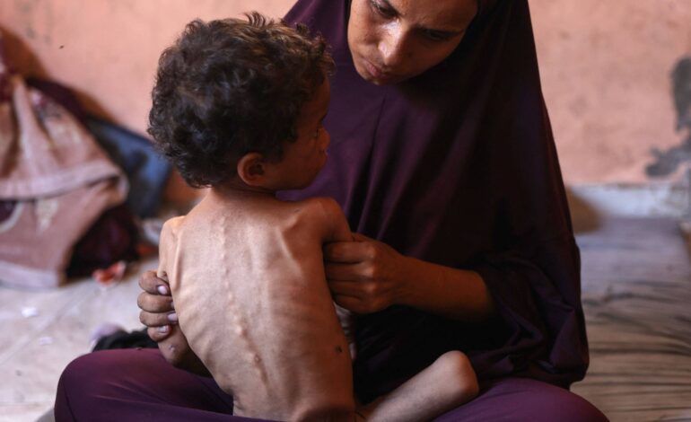 e-hora-de-sancoes-contra-israel-para-cessar-a-carnificina-em-gaza