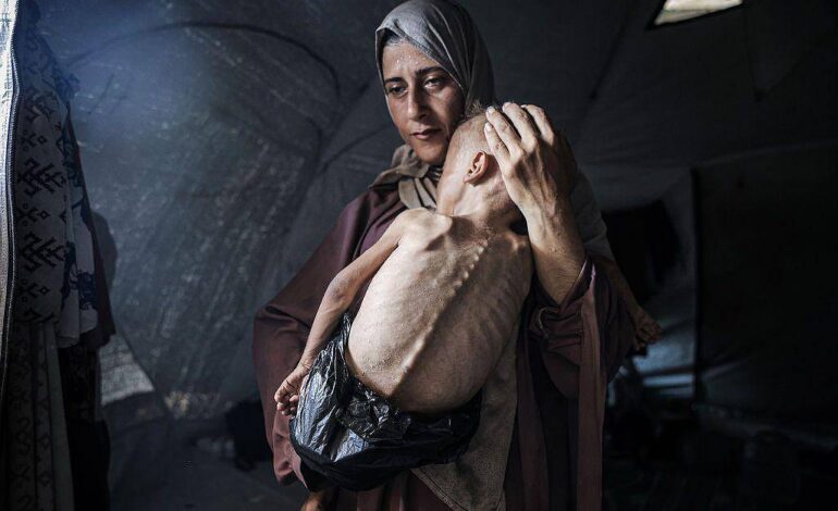 new-york-times-se-retrata-e-inclui-contexto-de-foto-de-bebe-desnutrido-em-gaza-apos-criticas