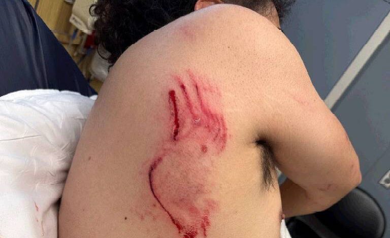 agentes-de-imigracao-usam-cao-contra-homem-durante-abordagem-nos-eua;-veja-video