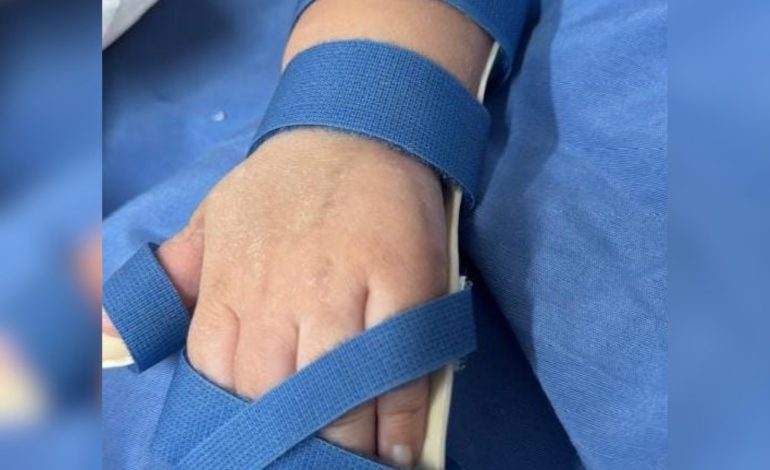 Estudantes criam suporte sob medida para ajudar na reabilitação de criança em hospital no TO